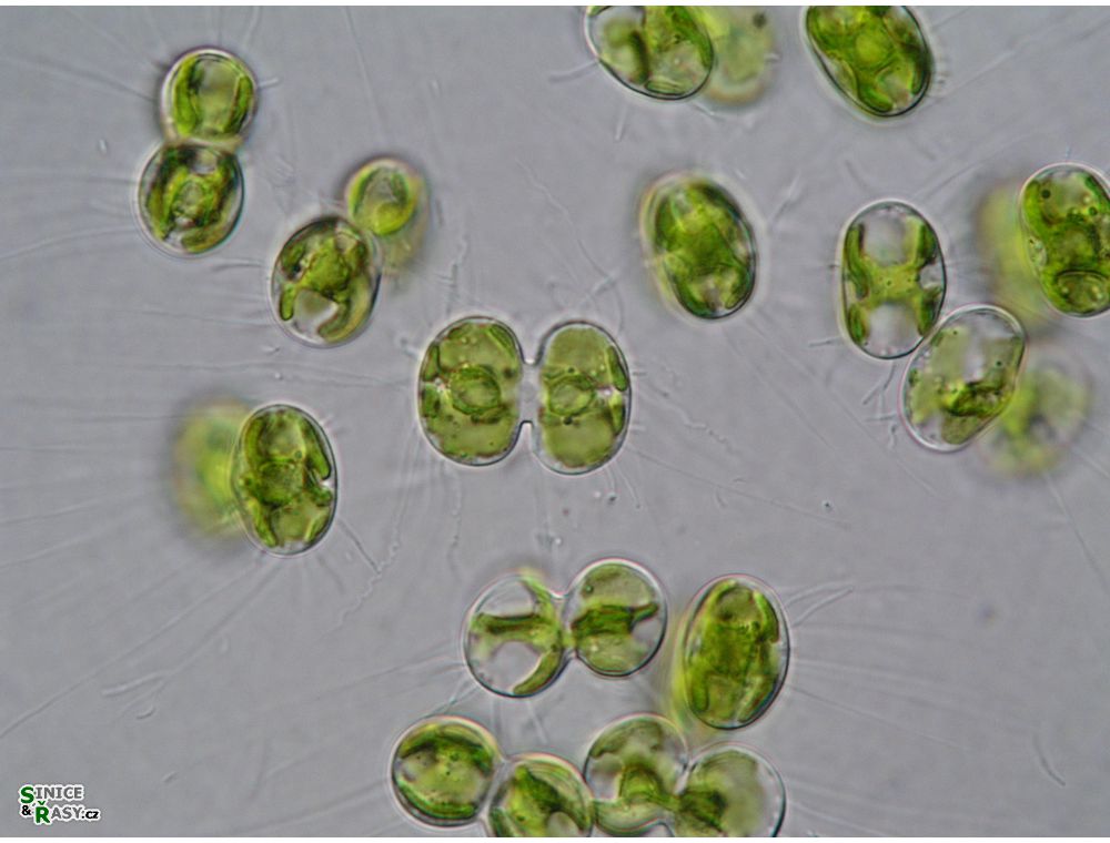 Cosmocladium saxonicum