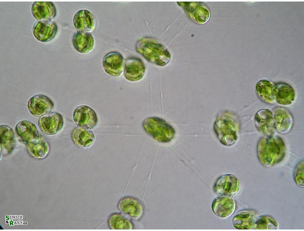 Cosmocladium saxonicum
