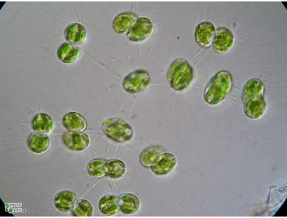 Cosmocladium saxonicum