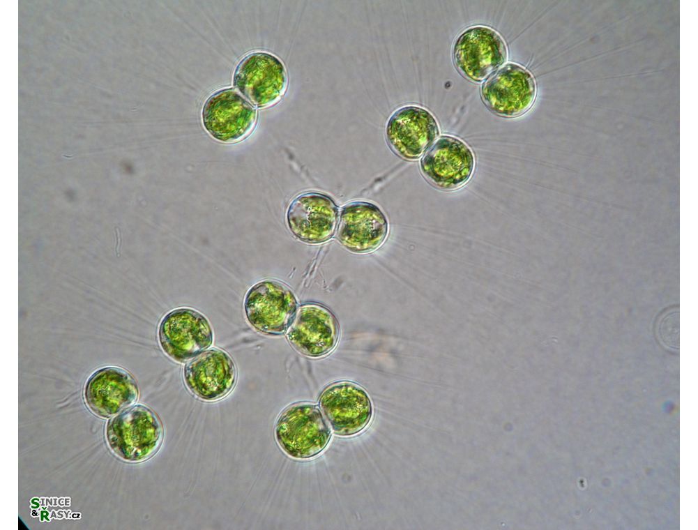 Cosmocladium saxonicum