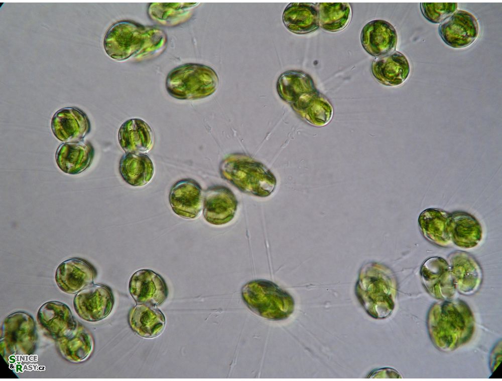 Cosmocladium saxonicum