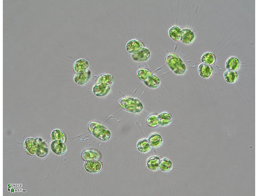 Cosmocladium saxonicum
