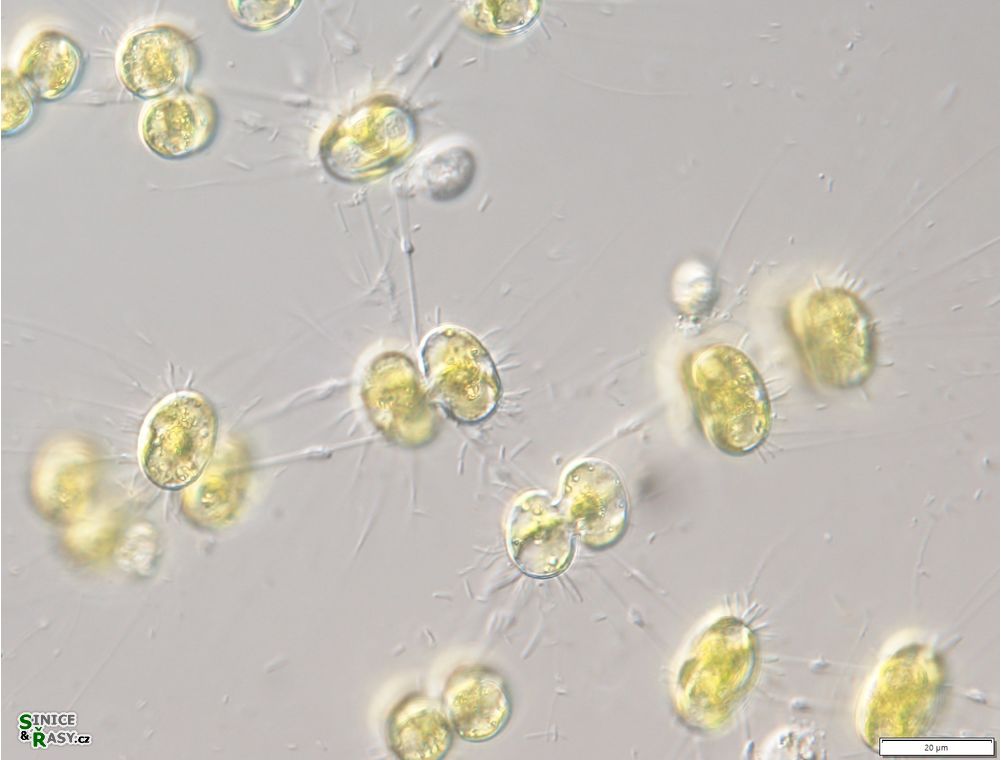 Cosmocladium saxonicum