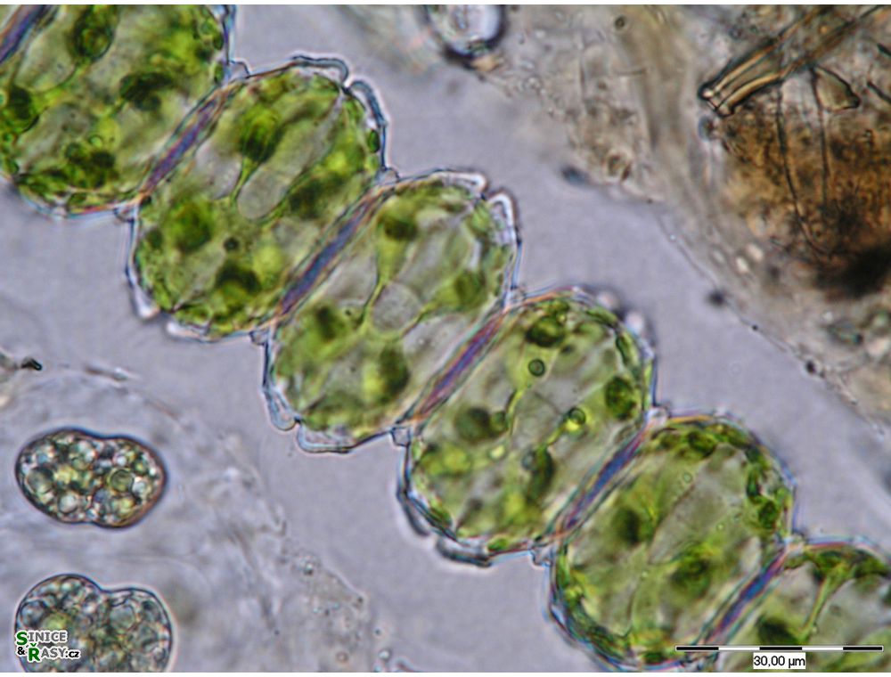 Desmidium cylindricum