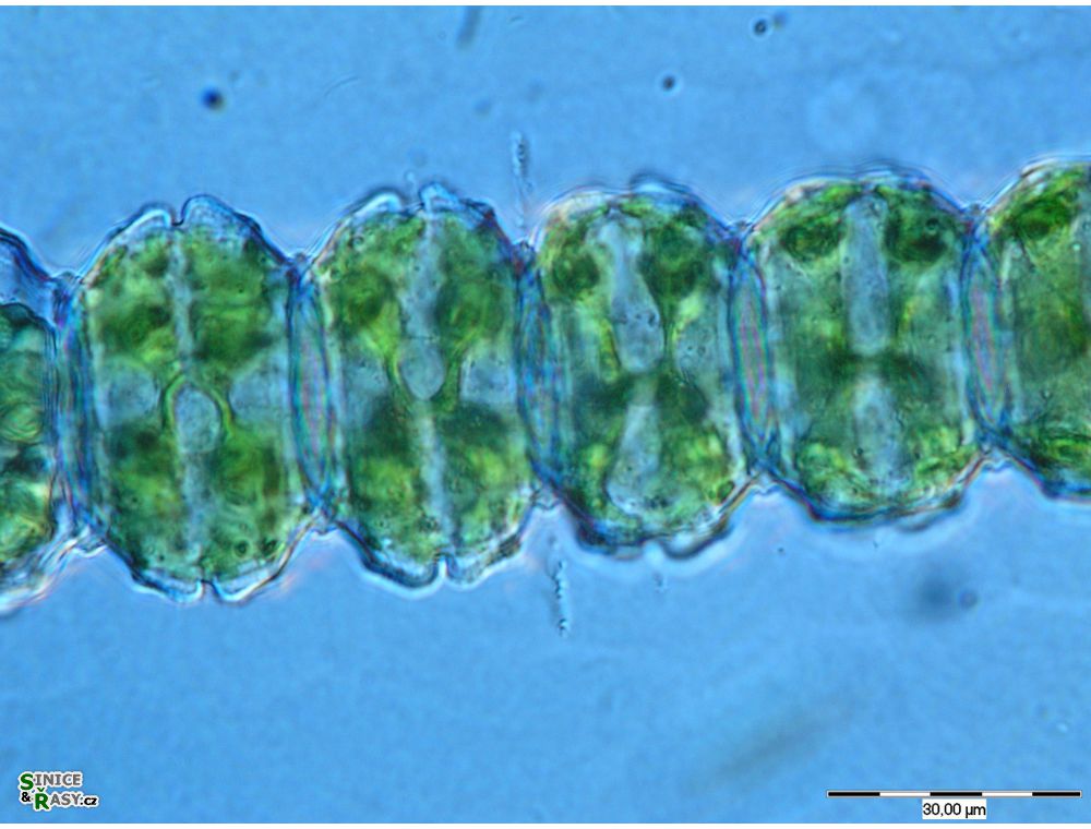 Desmidium cylindricum