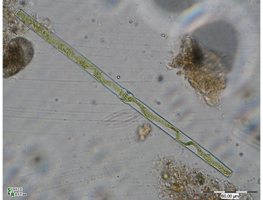 Docidium baculum