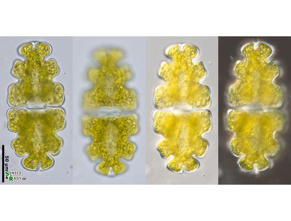 Euastrum oblongum