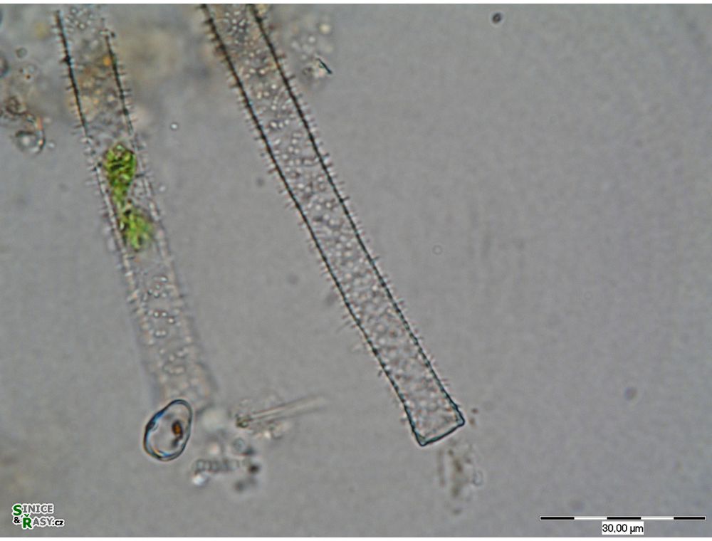Gonatozygon aculeatum