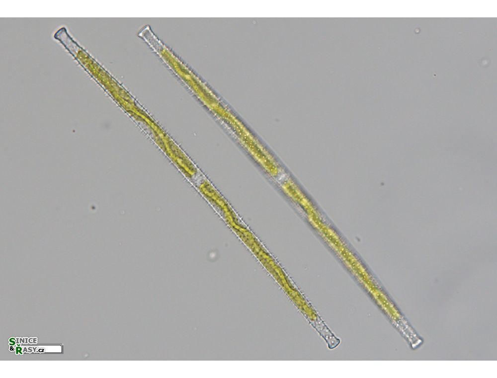 Gonatozygon aculeatum