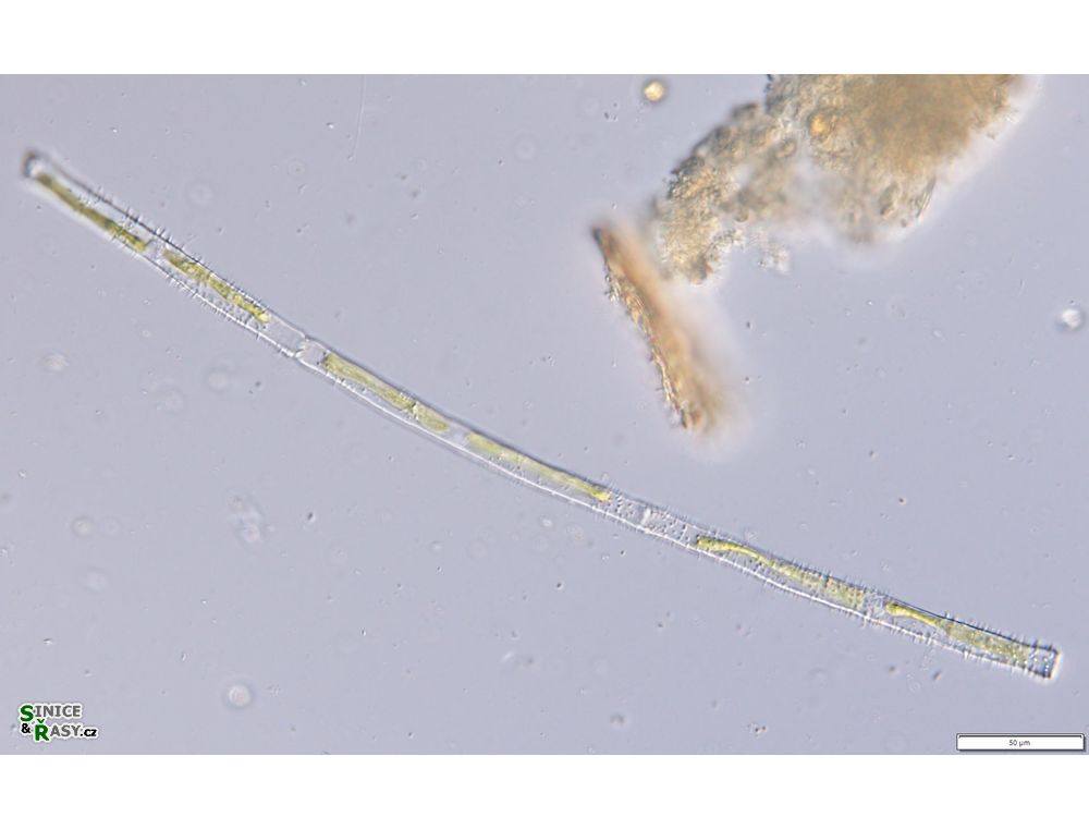 Gonatozygon aculeatum