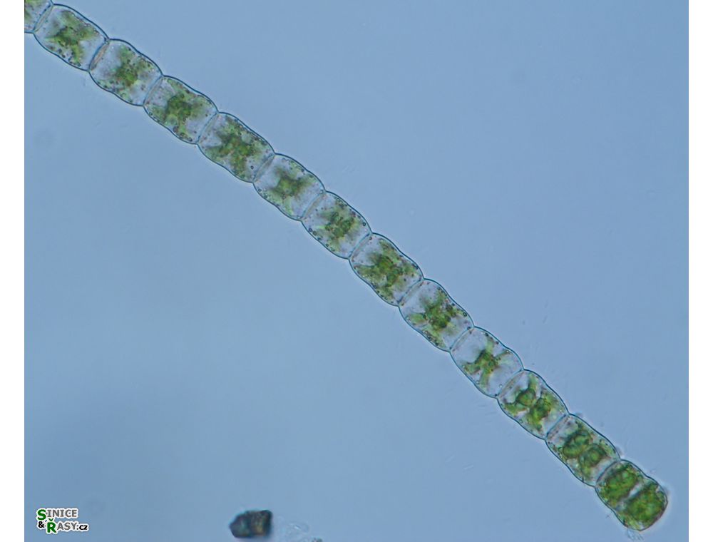 Hyalotheca