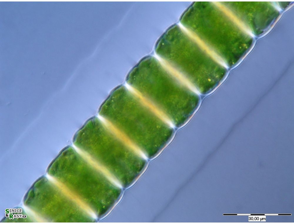 Hyalotheca dissiliens