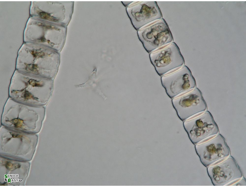 Hyalotheca dissiliens