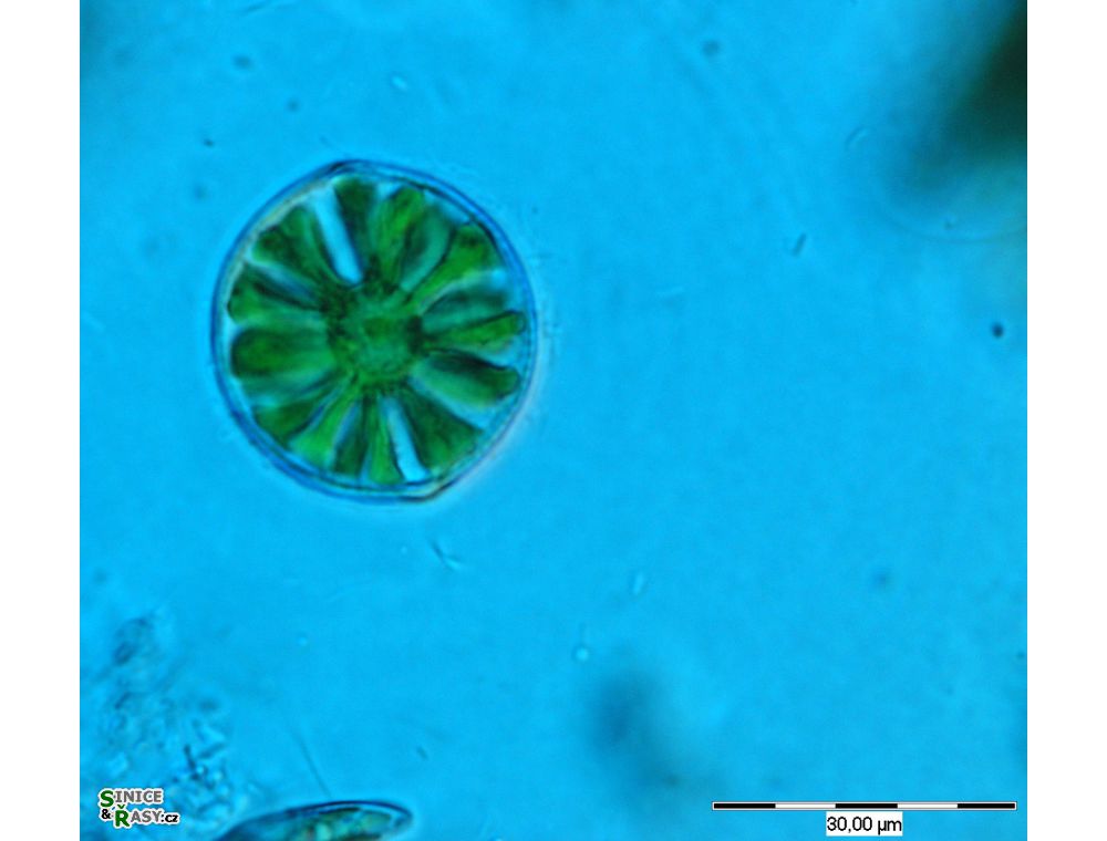 Hyalotheca dissiliens