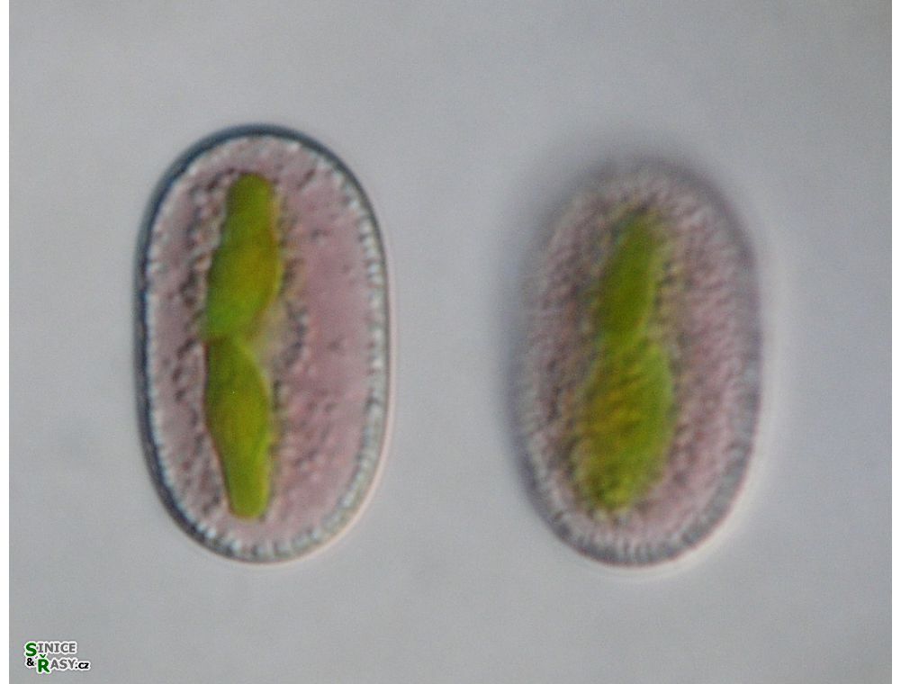 Mesotaenium