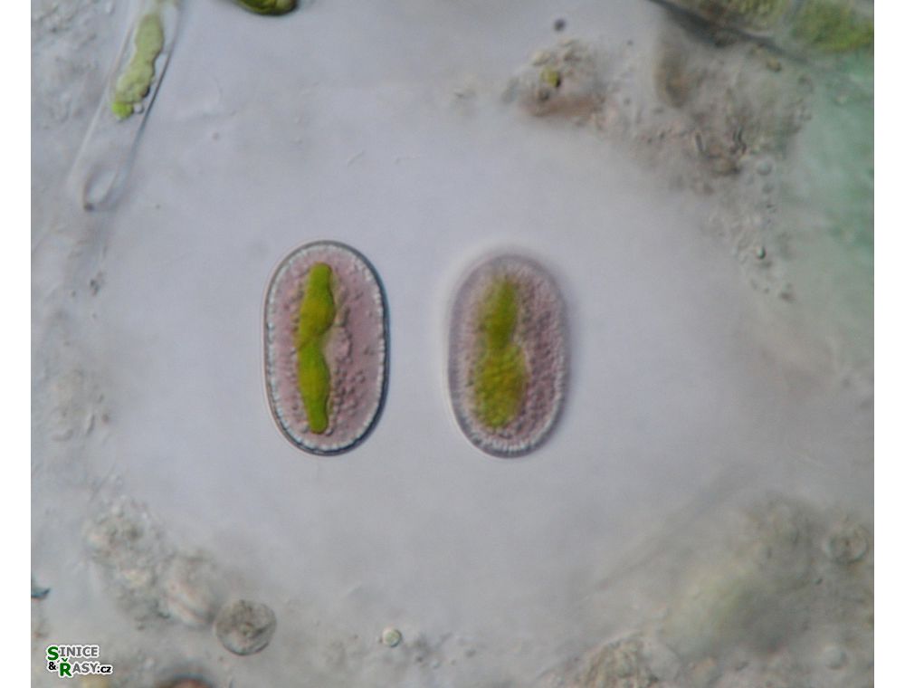Mesotaenium