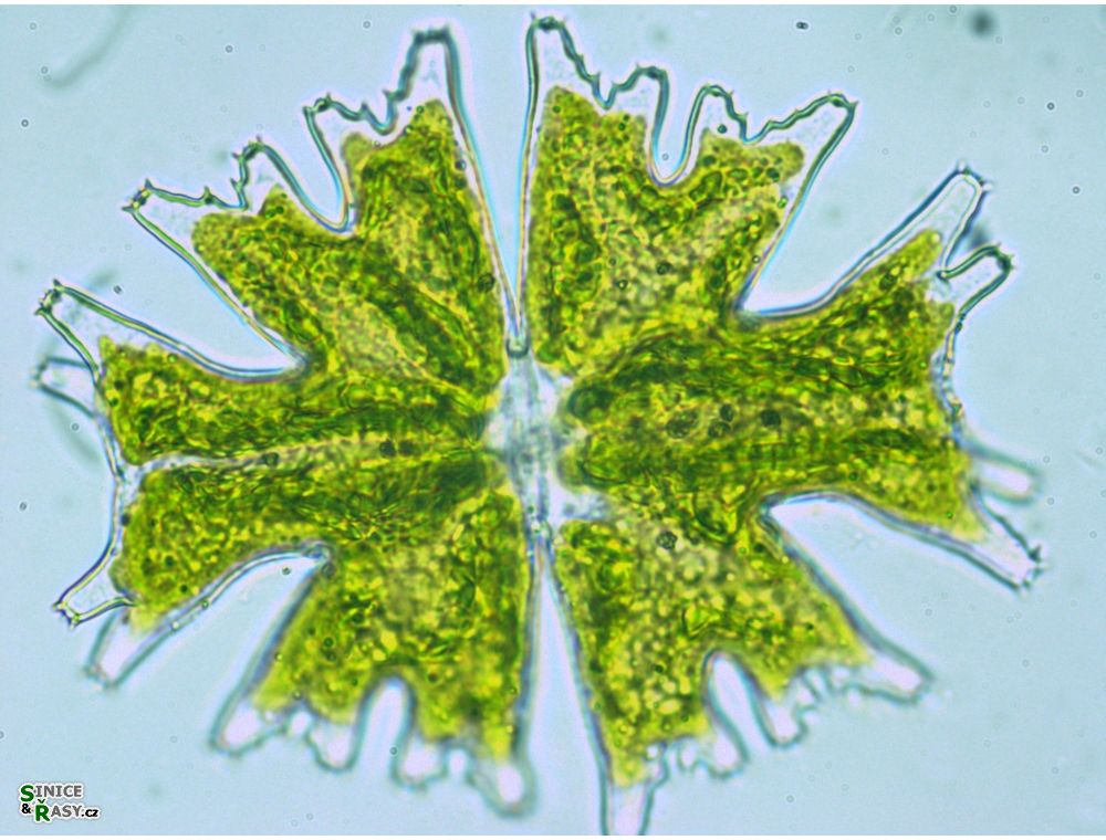 Micrasterias americana