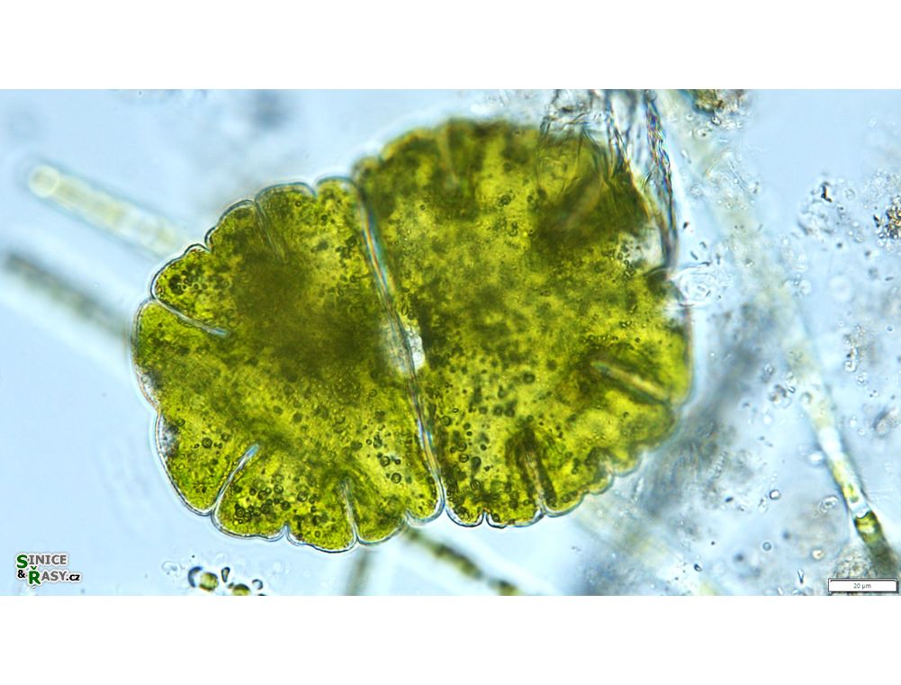 Micrasterias jenneri
