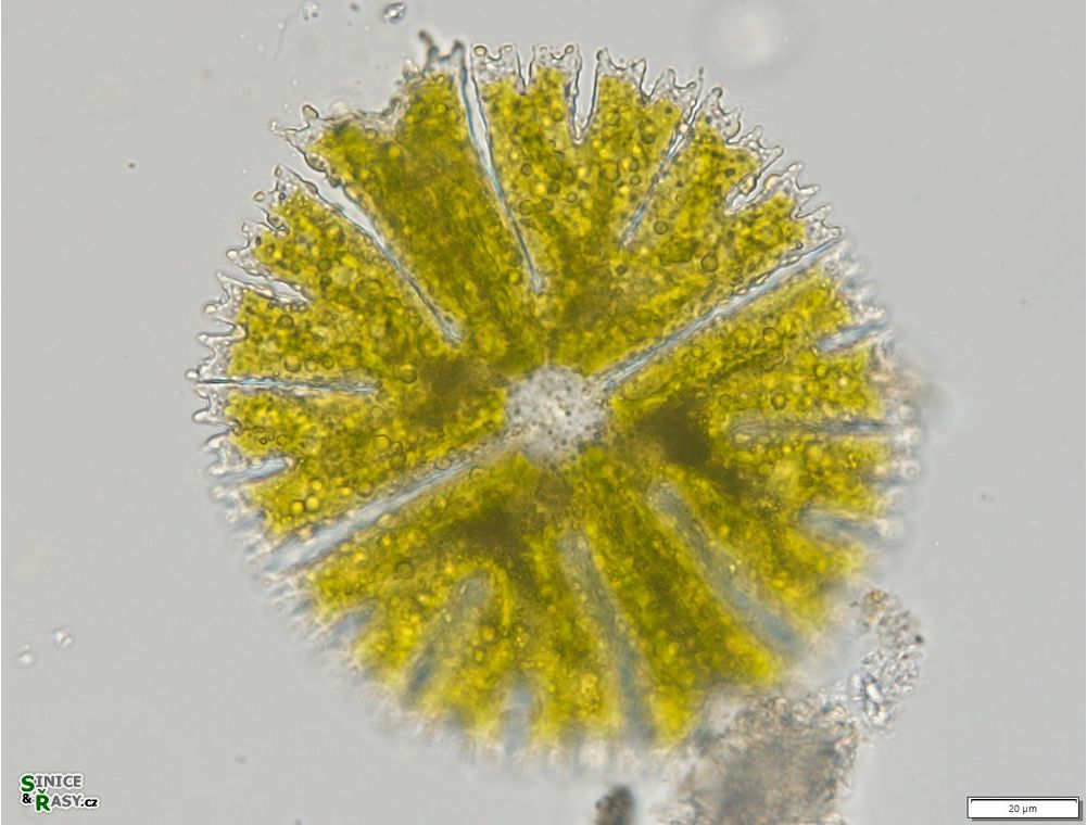 Micrasterias papillifera