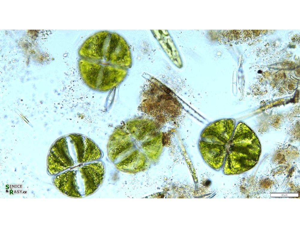 Micrasterias ralfsii