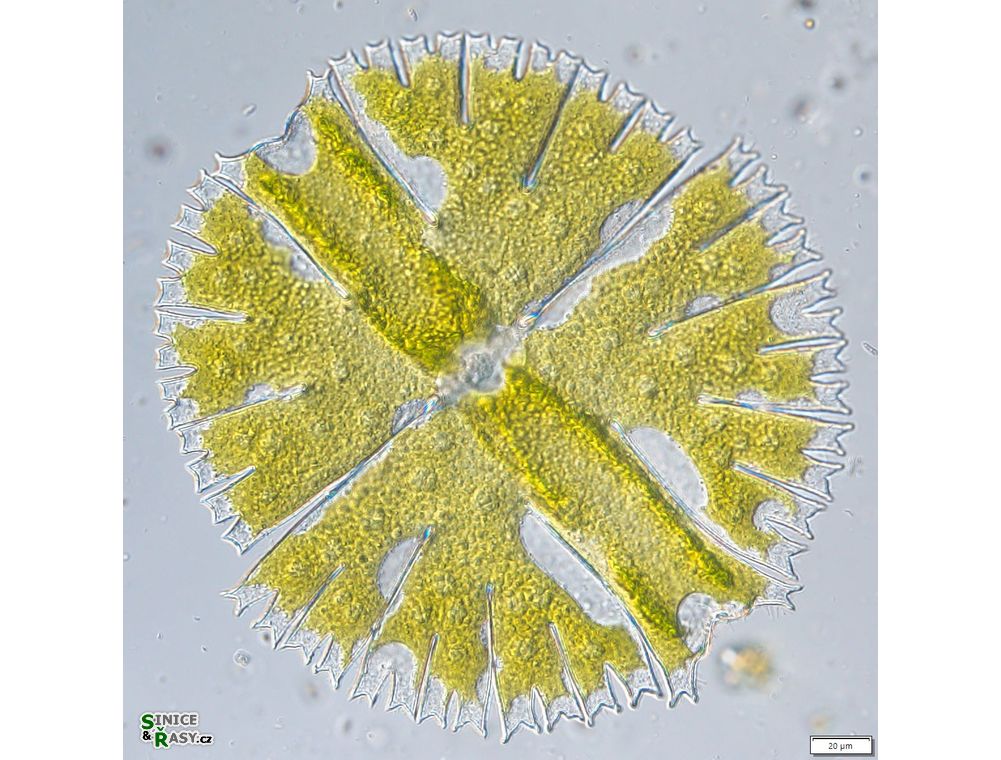 Micrasterias rotata
