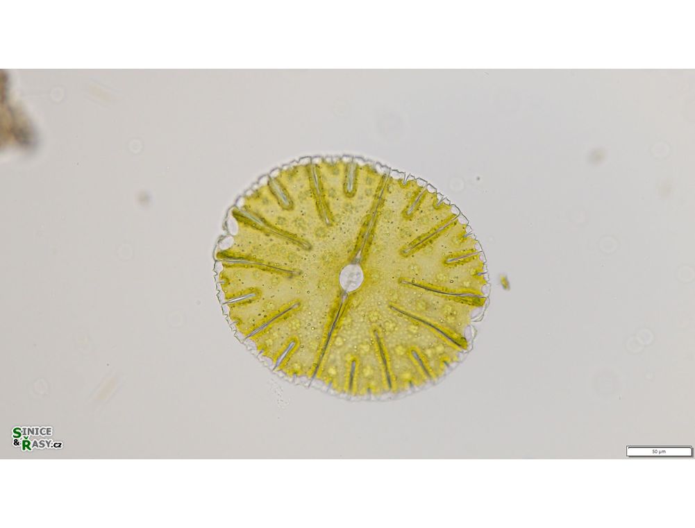 Micrasterias thomasiana