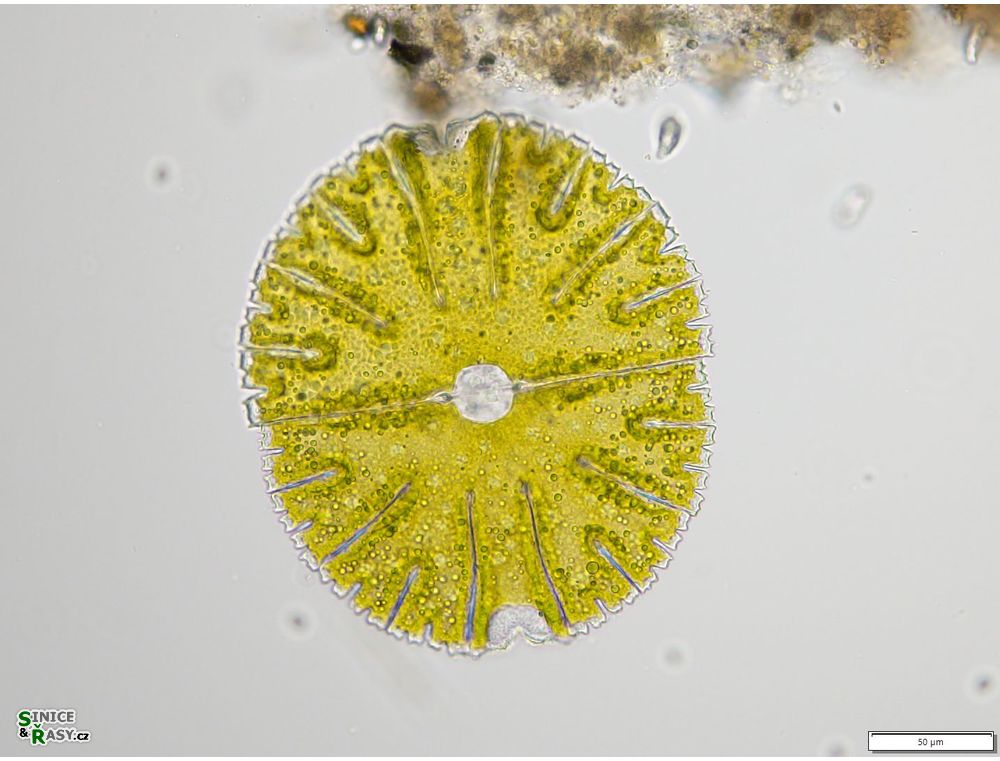 Micrasterias thomasiana