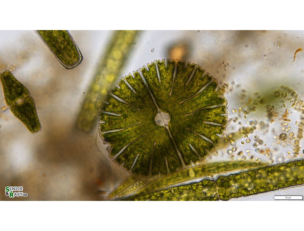 Micrasterias thomasiana