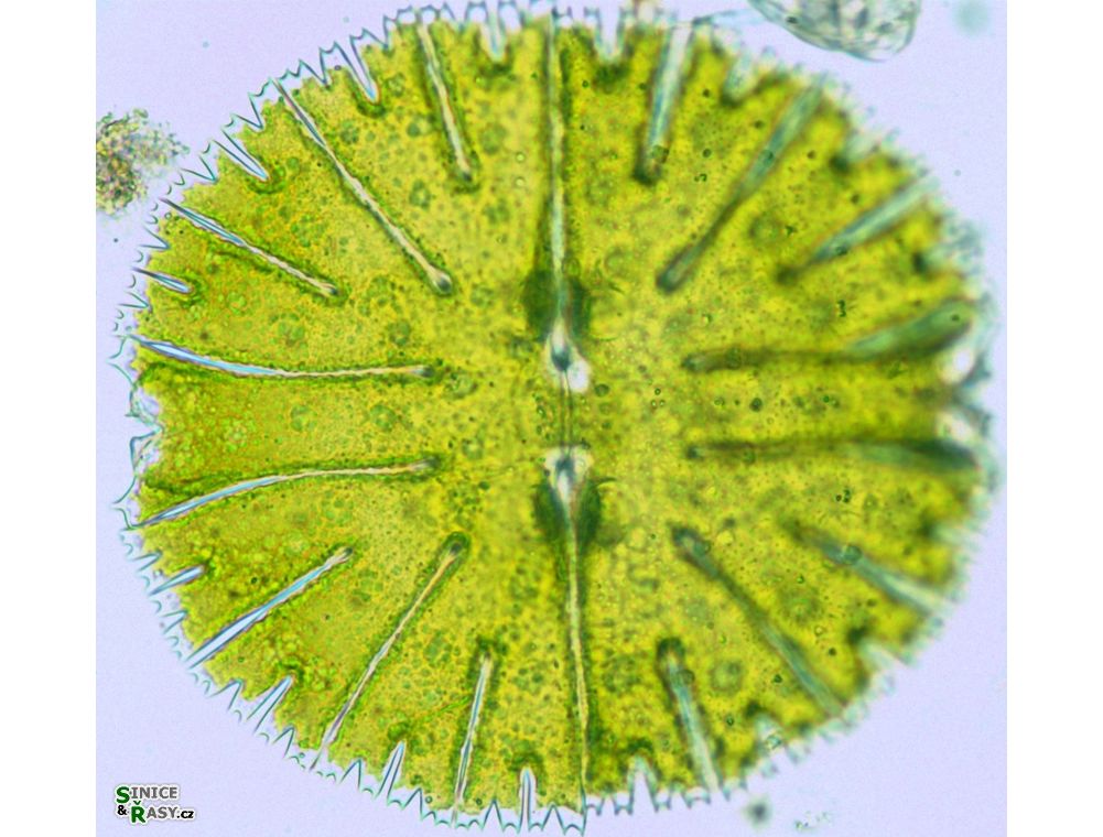 Micrasterias thomasiana