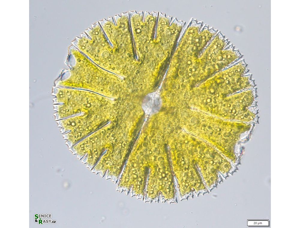 Micrasterias thomasiana
