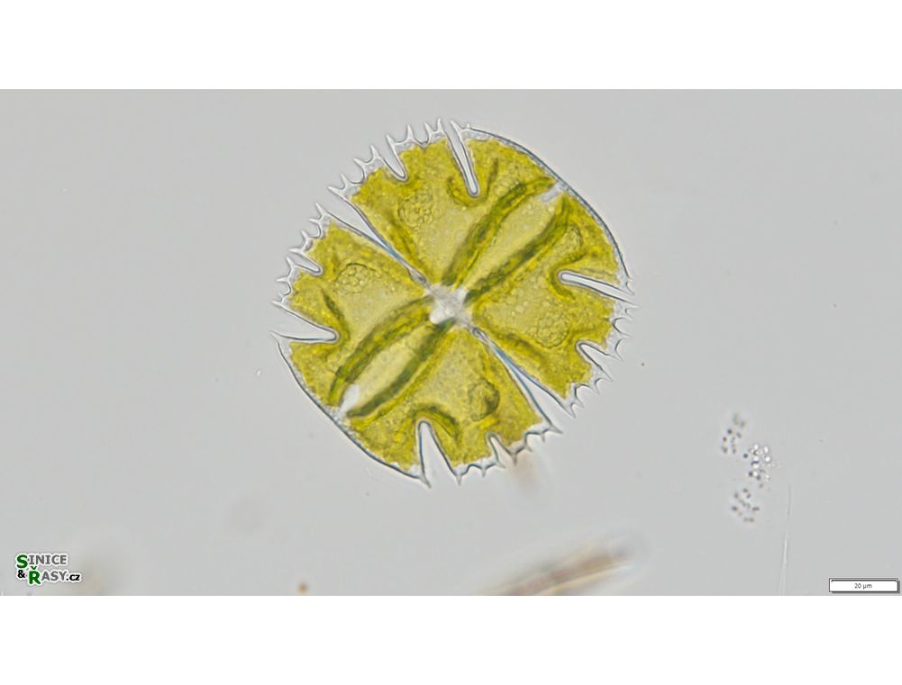 Micrasterias truncata