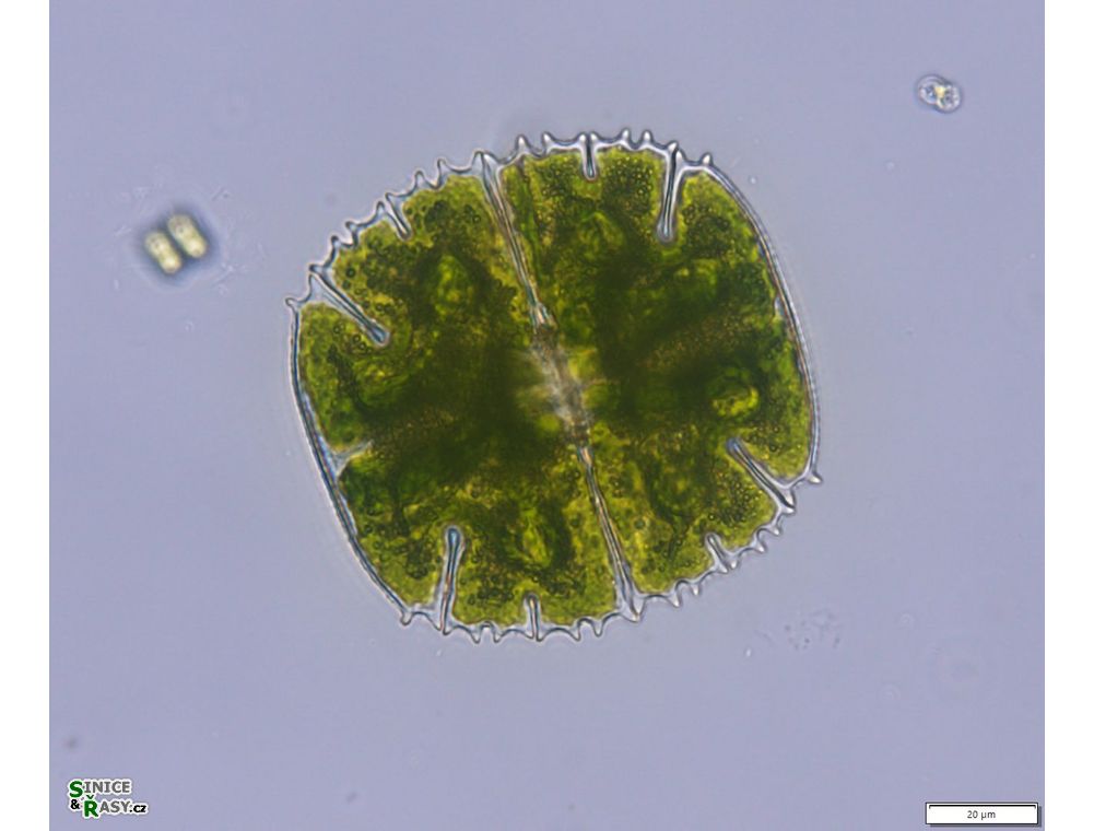 Micrasterias truncata