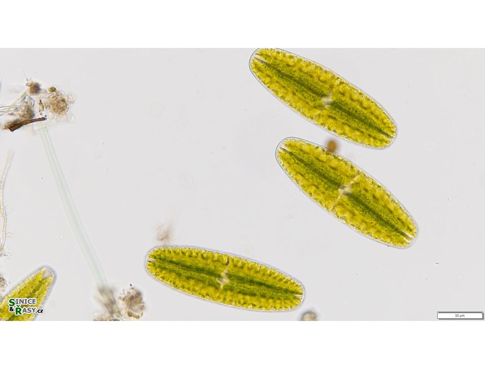 Netrium digitus