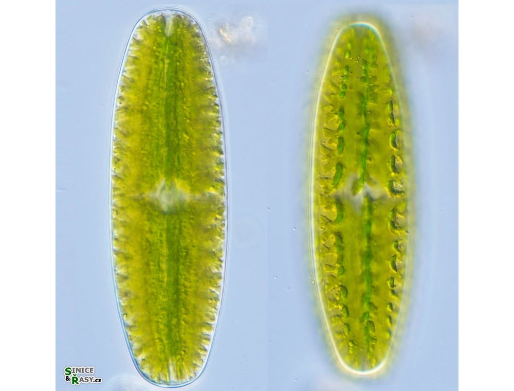 Netrium digitus