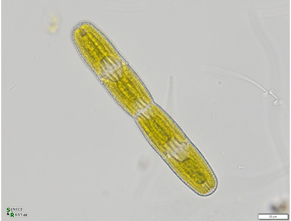 Penium margaritaceum