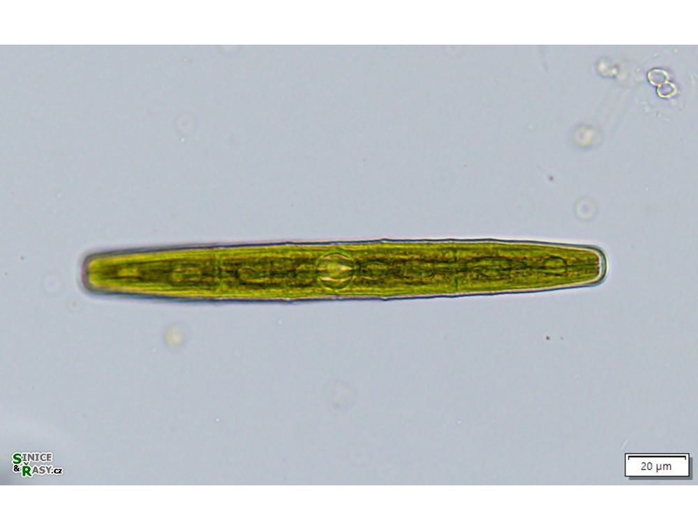 Penium spirostriolatum