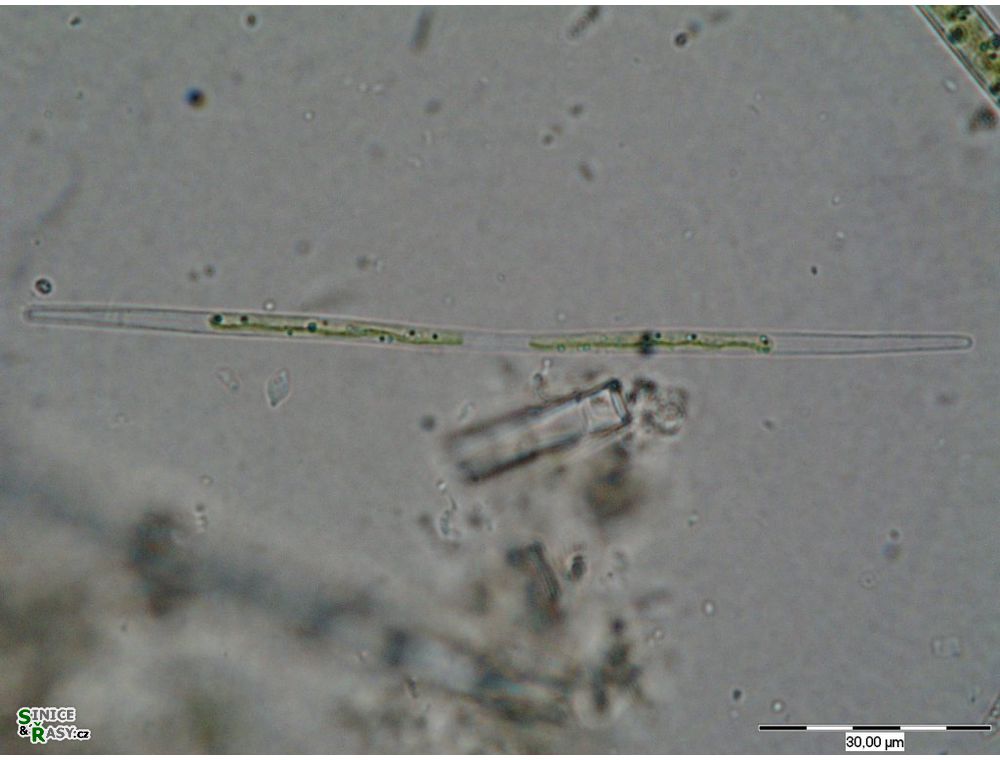 roya-pseudoclosterium-deleni