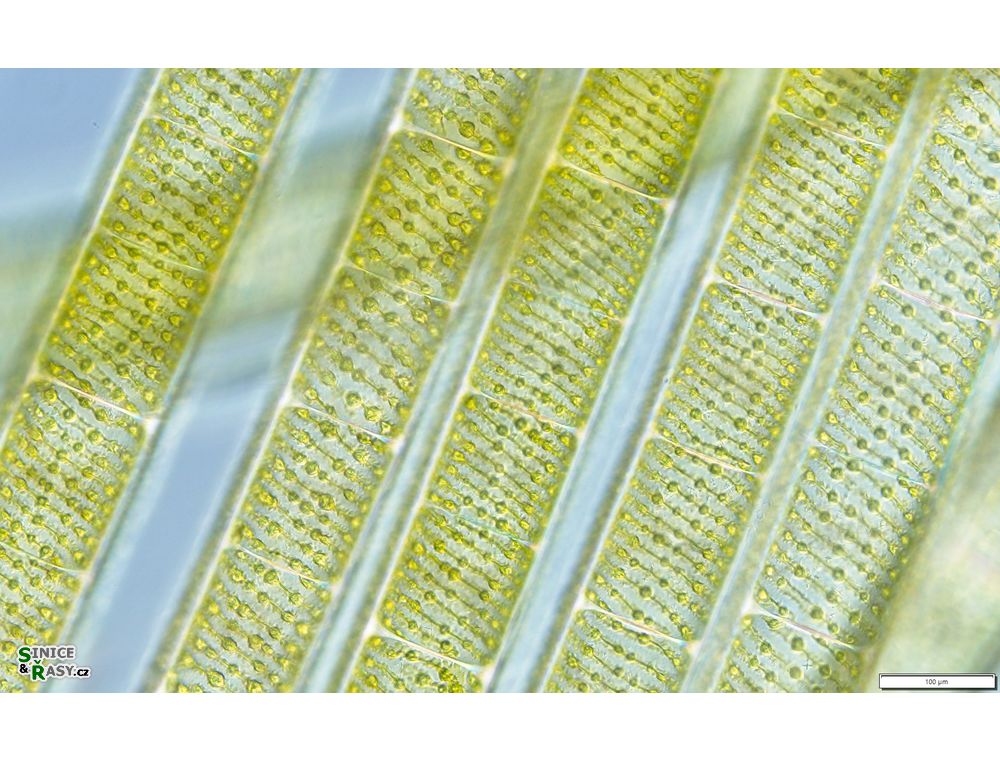 Spirogyra