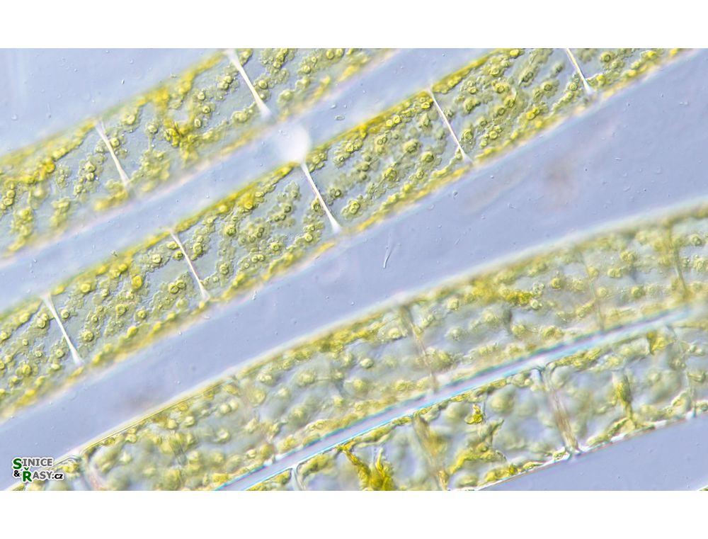 Spirogyra
