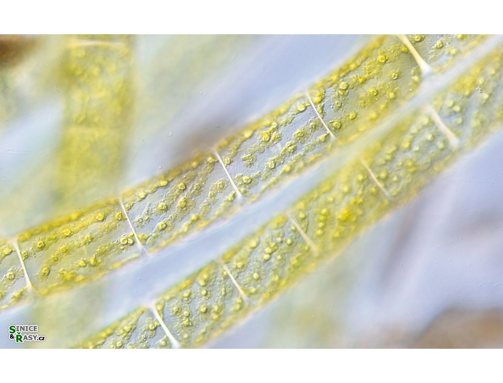 Spirogyra