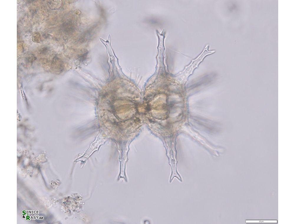 Staurastrum arctiscon