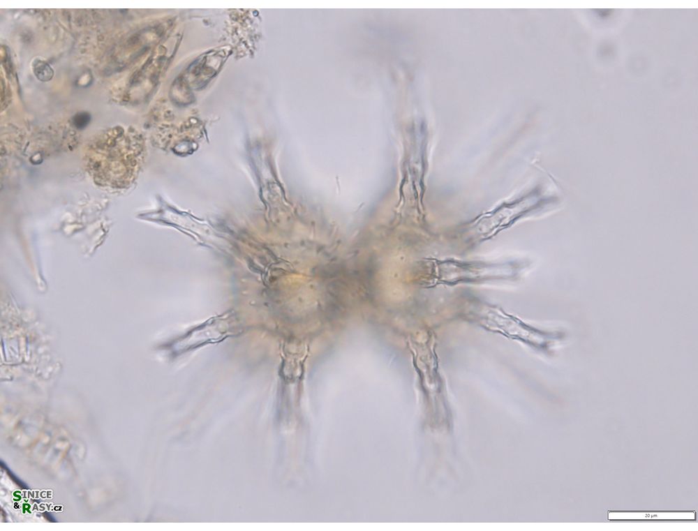 Staurastrum arctiscon