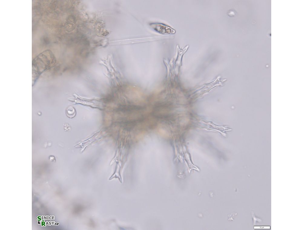 Staurastrum arctiscon