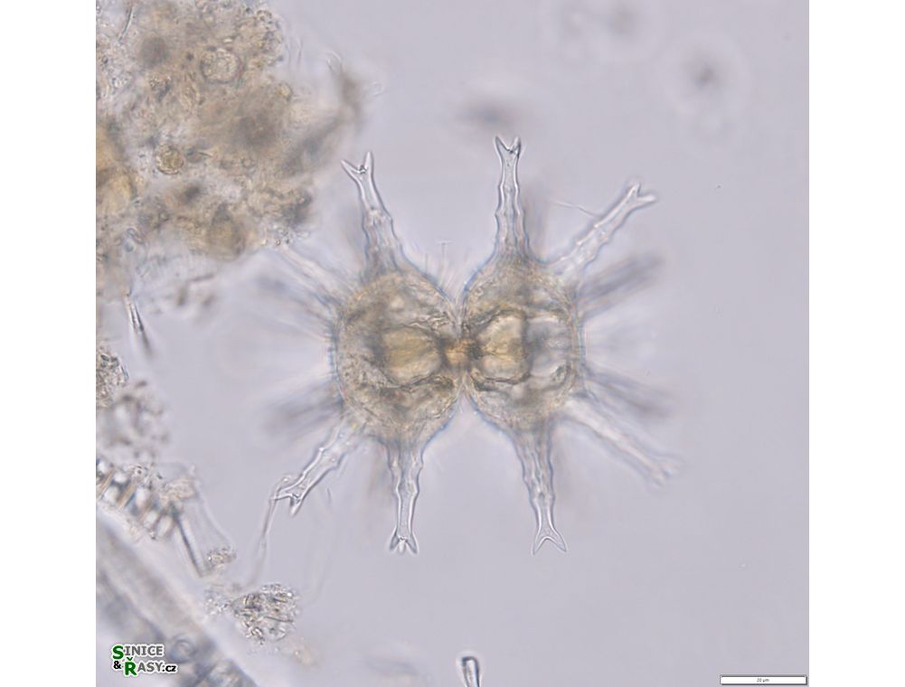 Staurastrum arctiscon