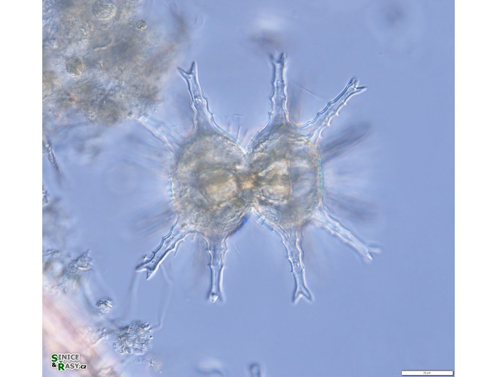 Staurastrum arctiscon
