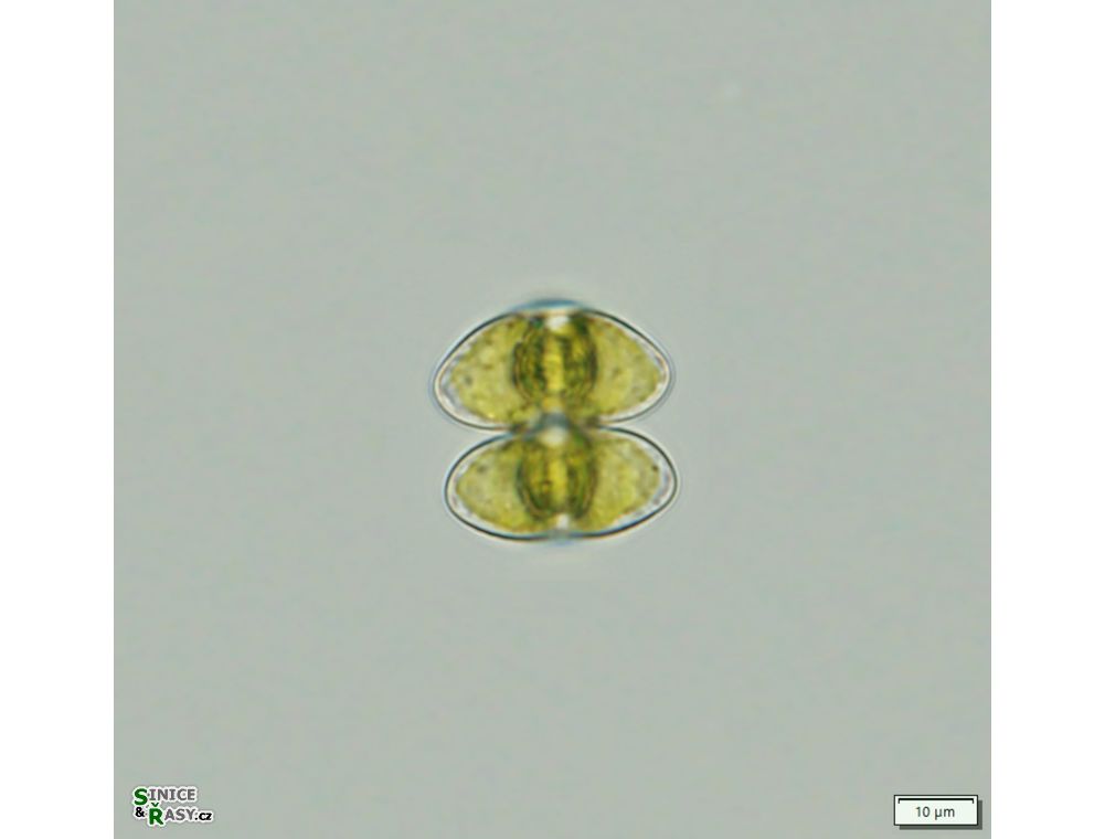 Staurastrum bieneanum
