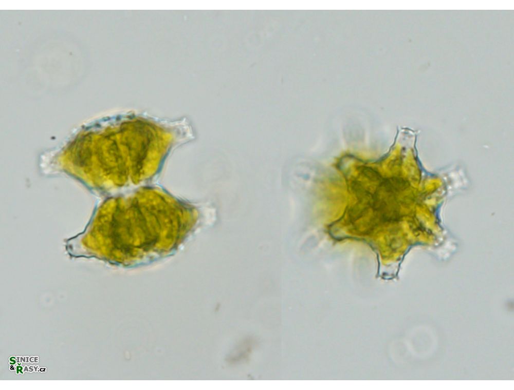 Staurastrum sexcostatum