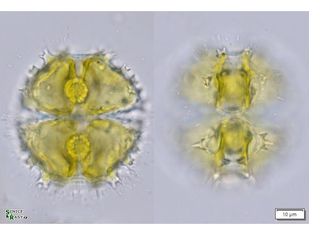 Staurastrum spongiosum