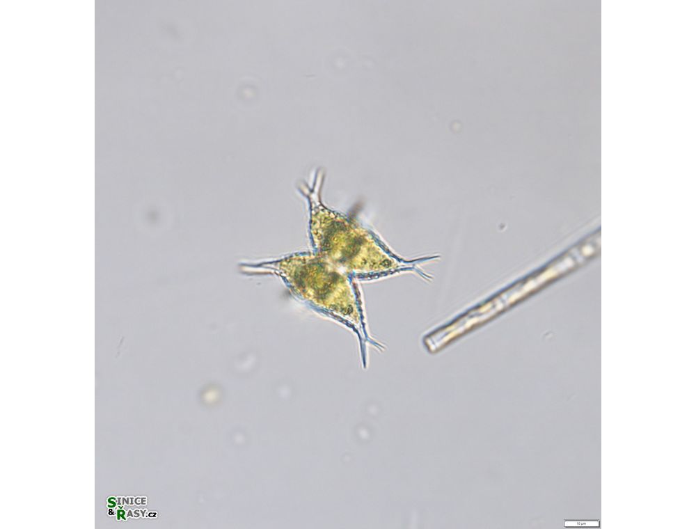 Staurastrum subcruciatum
