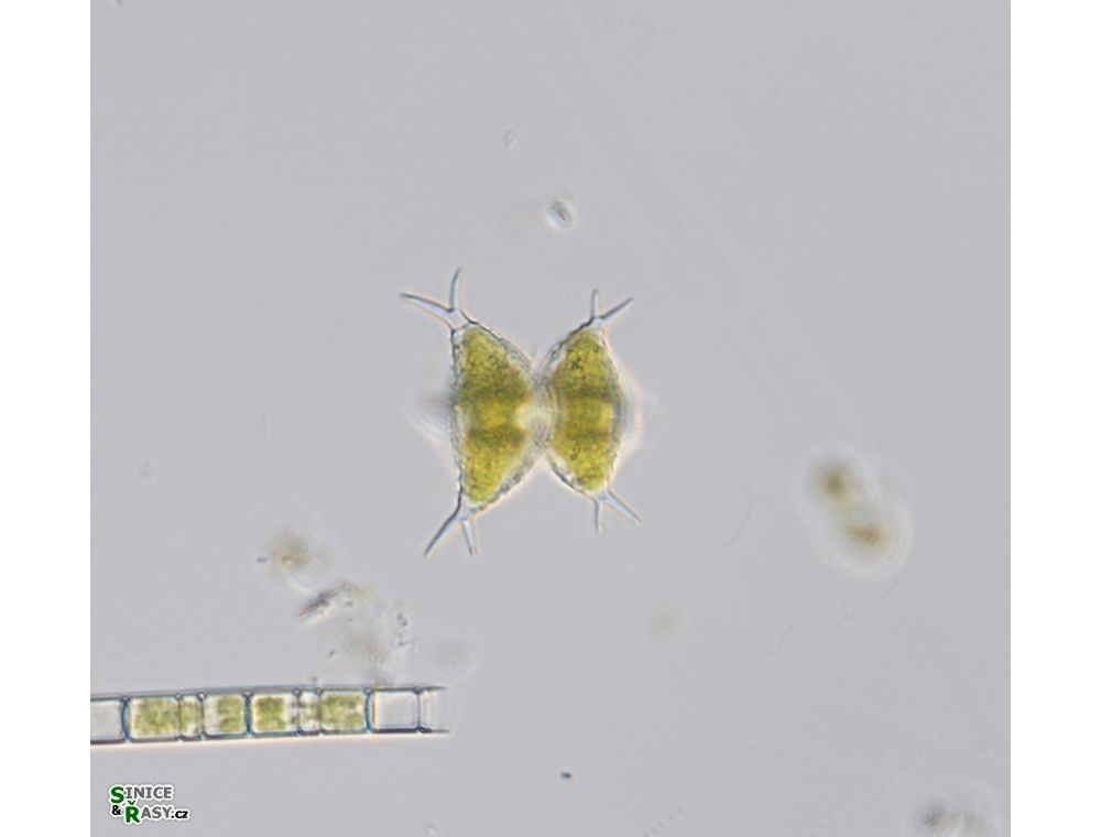 Staurastrum subcruciatum